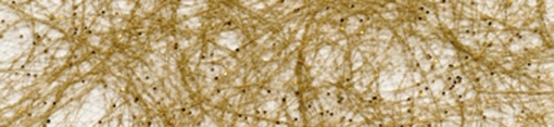 1870 gold metallic